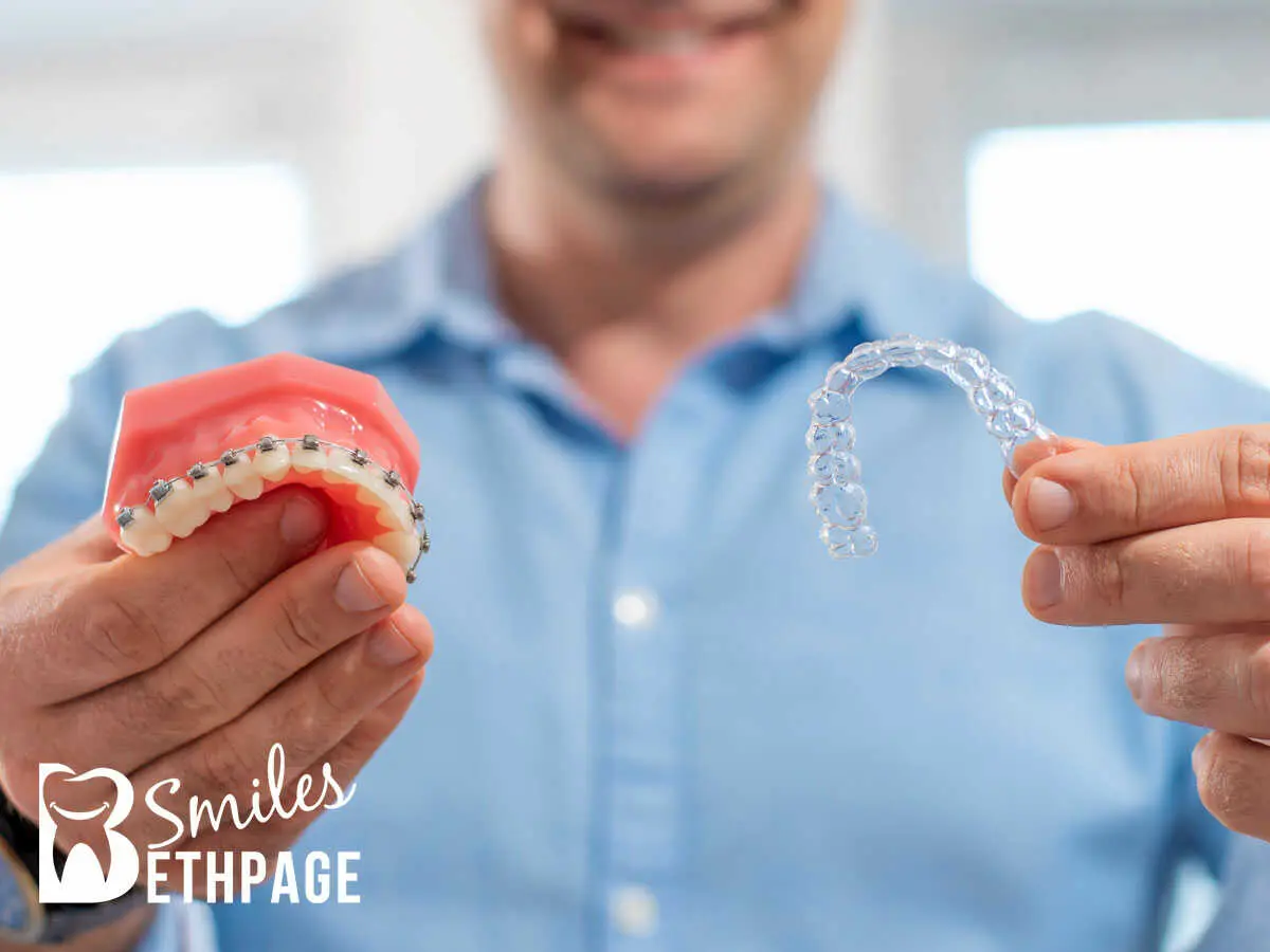 How Are Clear Aligners Better Than Ceramic Braces?